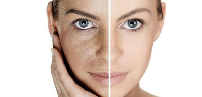 prima e dopo il ringiovanimento della pelle del viso