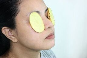 l'uso delle patate per il ringiovanimento del contorno occhi